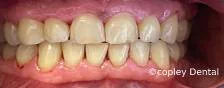 CASE 45: Cosmetic Dentistry - Before
